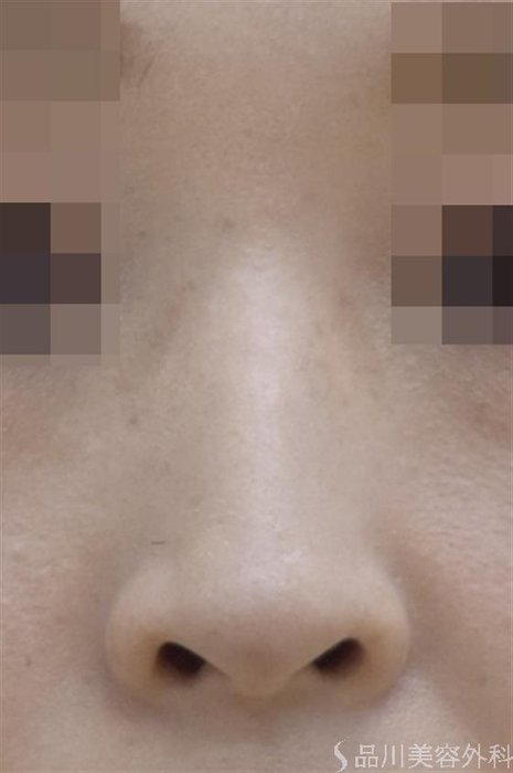 症例NO.47265のBEFORE写真