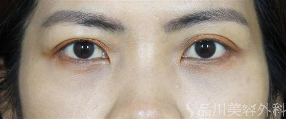 症例NO.60265のAFTER写真