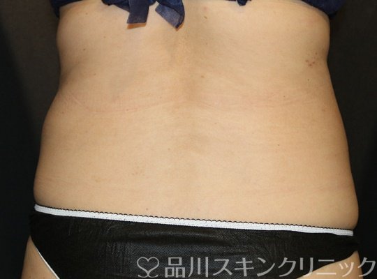 症例NO.73888のAFTER写真