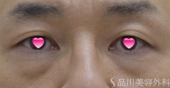 症例NO.50256のBEFORE写真