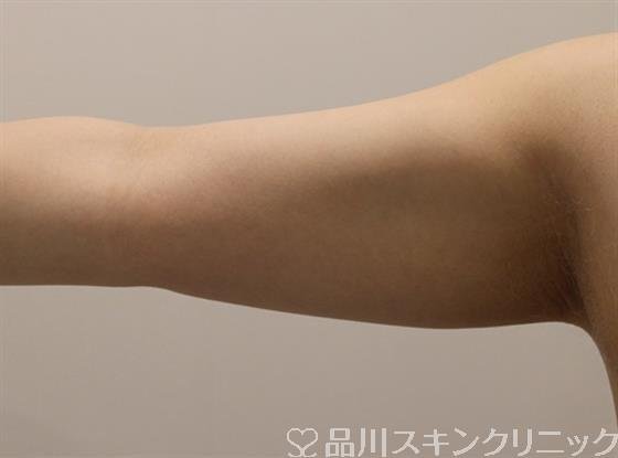 症例NO.47360のBEFORE写真