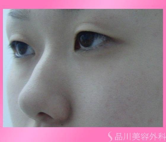 症例NO.7129のBEFORE写真