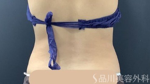 症例NO.75392のAFTER写真