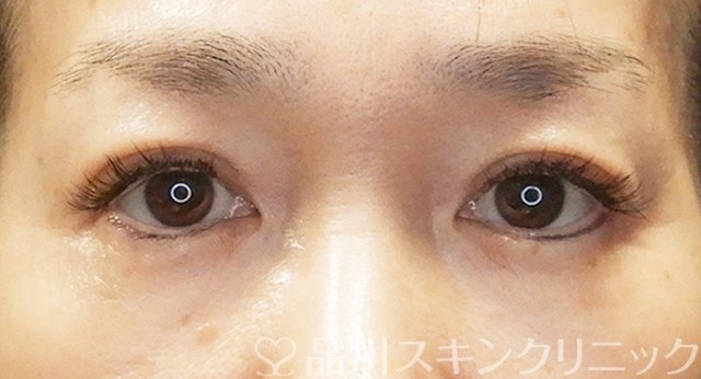症例NO.65457のAFTER写真