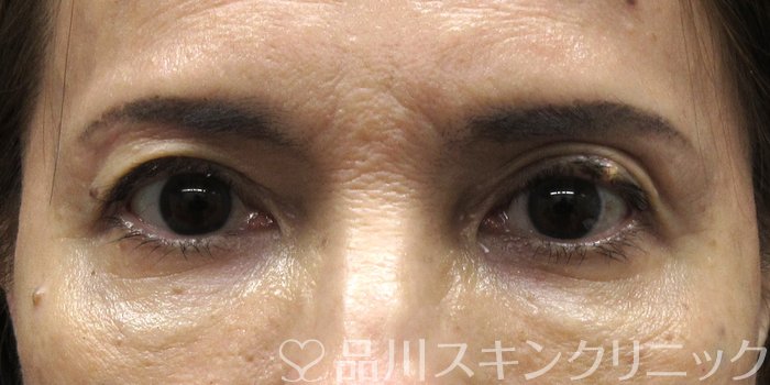 症例NO.74519のAFTER写真
