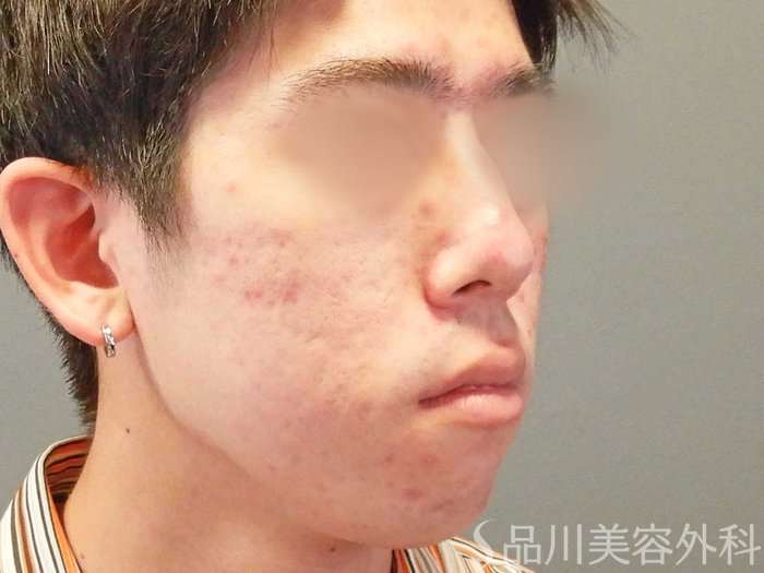 症例NO.67619のBEFORE写真