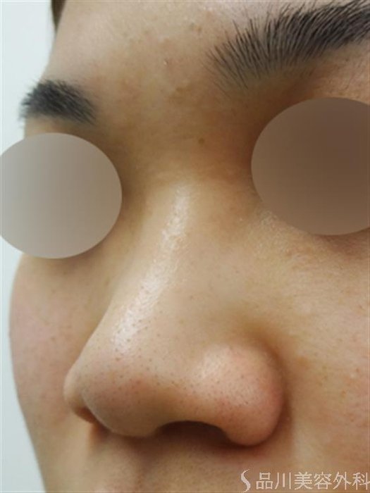 症例NO.30271のBEFORE写真