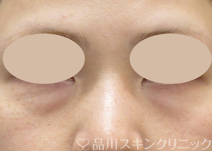 症例NO.73797のBEFORE写真