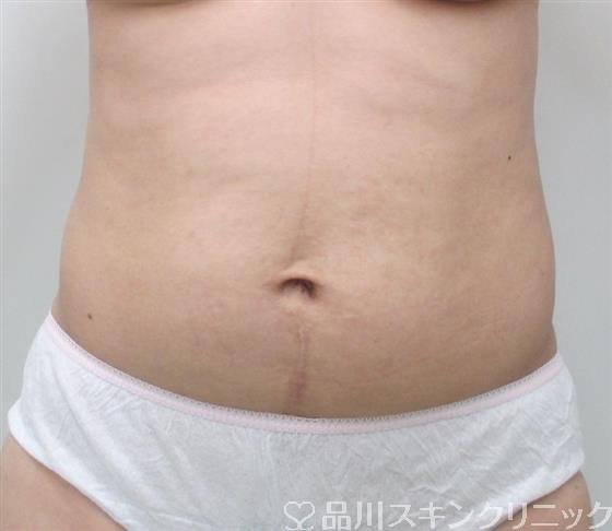 症例NO.27605のBEFORE写真