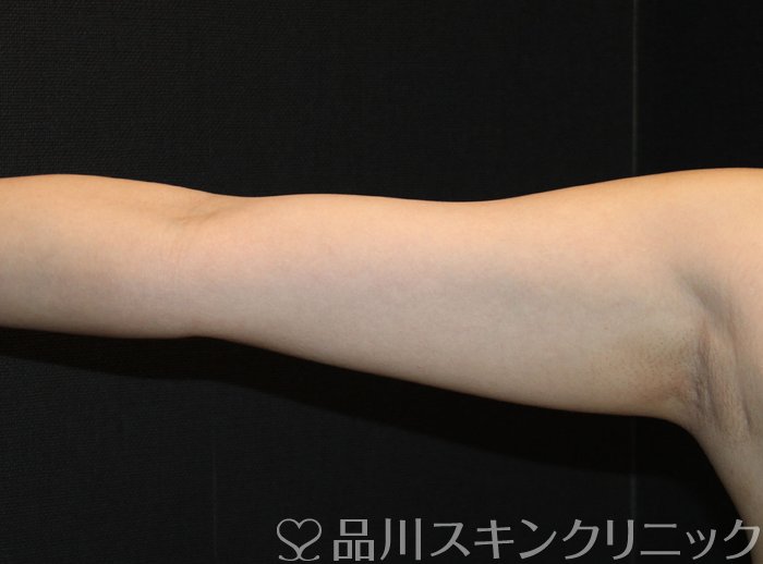 症例NO.74271のAFTER写真