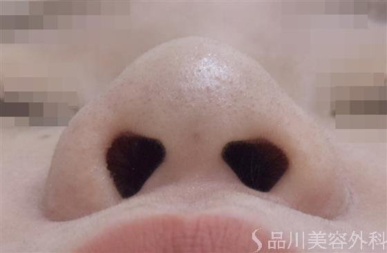 症例NO.48943のAFTER写真