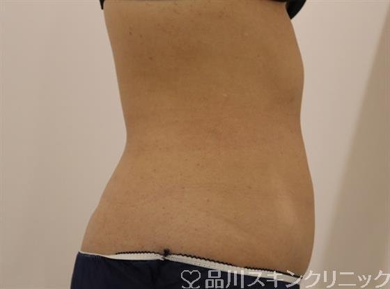症例NO.40805のAFTER写真