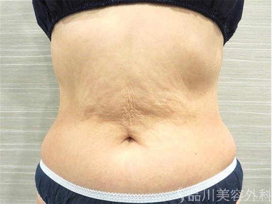 症例NO.20827のBEFORE写真