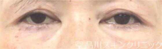 症例NO.29357のAFTER写真