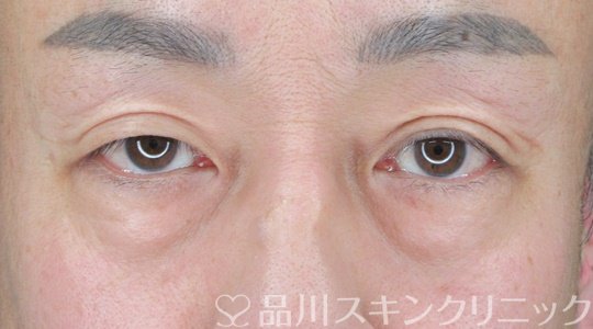 症例NO.69202のBEFORE写真