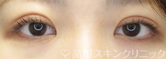 症例NO.69291のAFTER写真