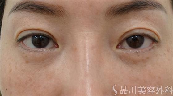 症例NO.47778のAFTER写真