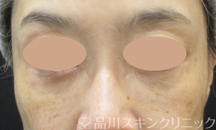症例NO.73859のAFTER写真