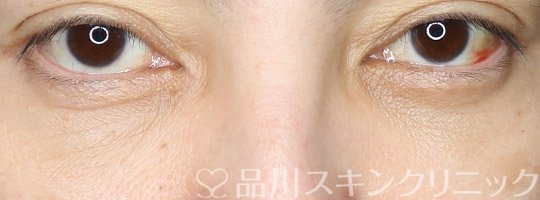 症例NO.69586のAFTER写真