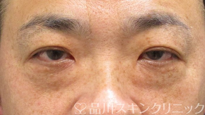 症例NO.73768のBEFORE写真