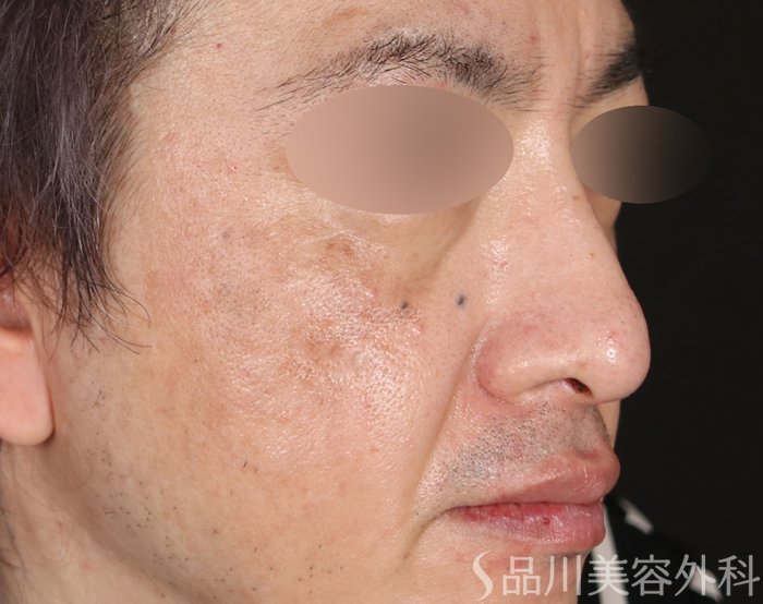 症例NO.72473のAFTER写真