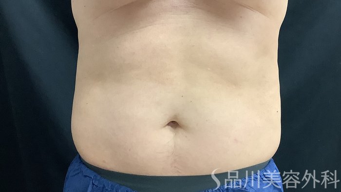 症例NO.75386のBEFORE写真