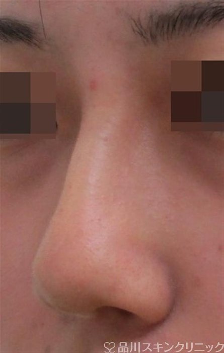 症例NO.30559のAFTER写真