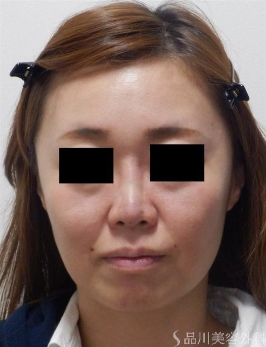 症例NO.12778のAFTER写真