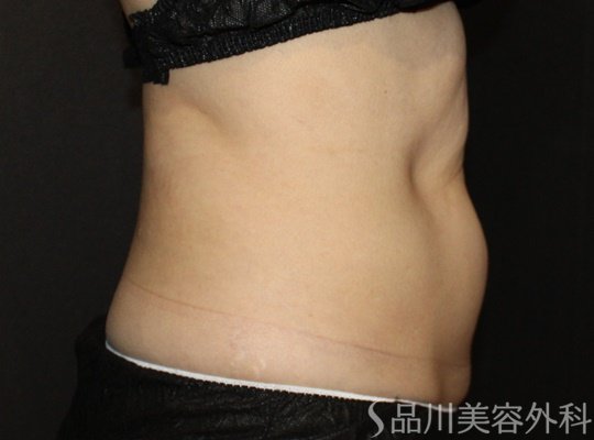 症例NO.73134のBEFORE写真