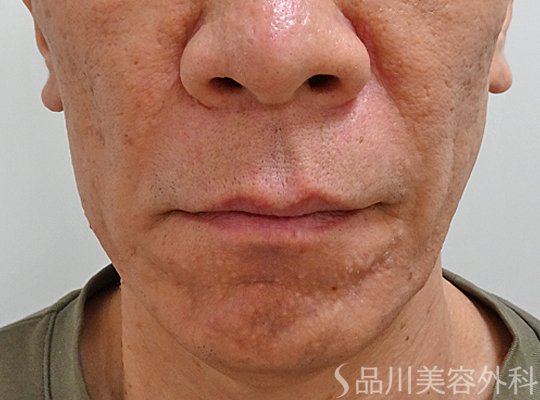 症例NO.73655のBEFORE写真