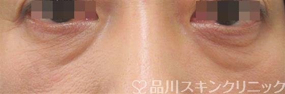 症例NO.26936のBEFORE写真