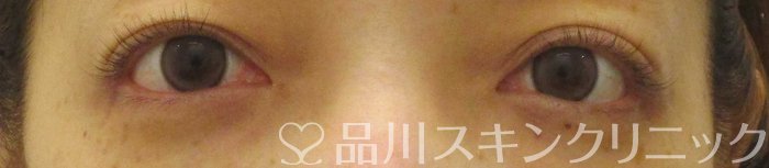 症例NO.66192のBEFORE写真