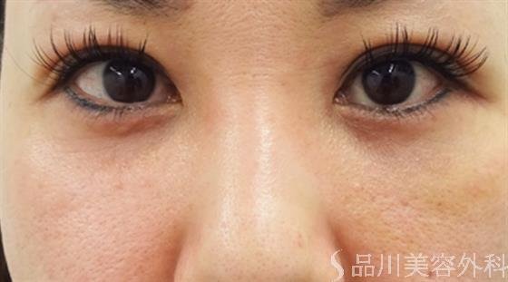 症例NO.40665のAFTER写真