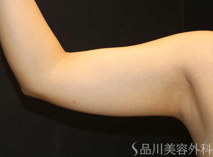 症例NO.71847のBEFORE写真