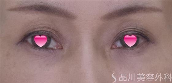 症例NO.50257のAFTER写真