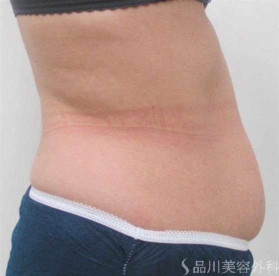 症例NO.22506のBEFORE写真
