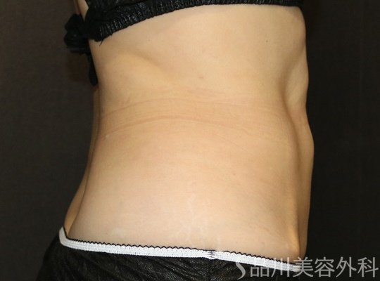 症例NO.73134のAFTER写真