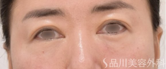 症例NO.71764のAFTER写真