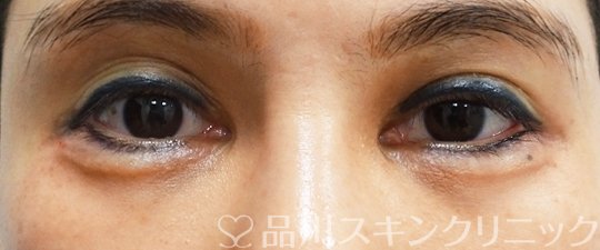 症例NO.70105のAFTER写真