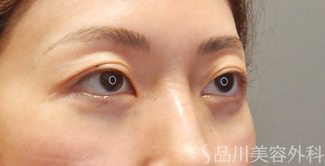 症例NO.73999のAFTER写真