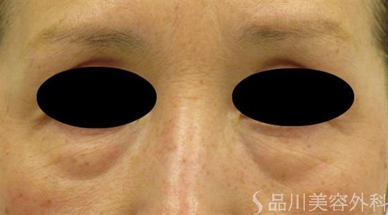 症例NO.47823のBEFORE写真