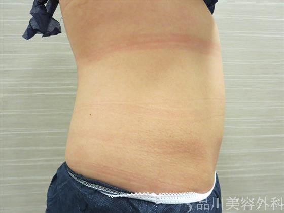 症例NO.21043のBEFORE写真