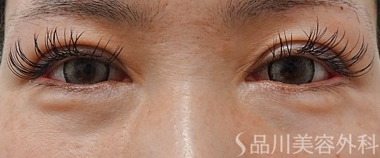 症例NO.73489のBEFORE写真