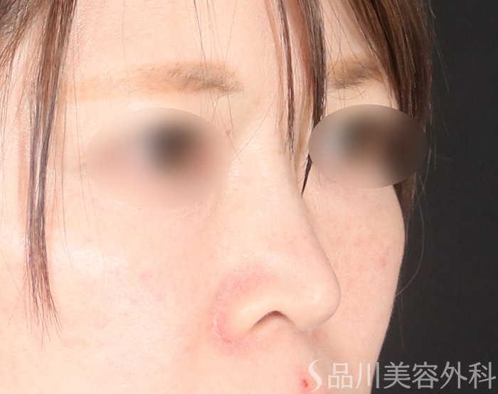 症例NO.73153のBEFORE写真