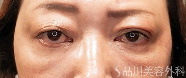 症例NO.69997のAFTER写真