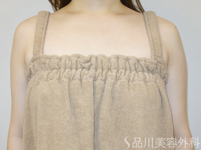 症例NO.73224のBEFORE写真