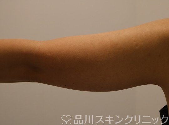 症例NO.71478のBEFORE写真