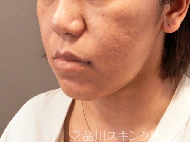 症例NO.70984のBEFORE写真