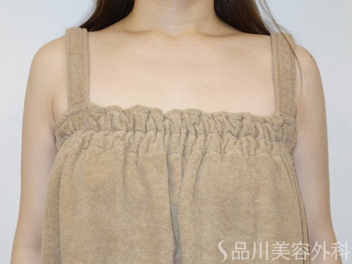 症例NO.73224のAFTER写真