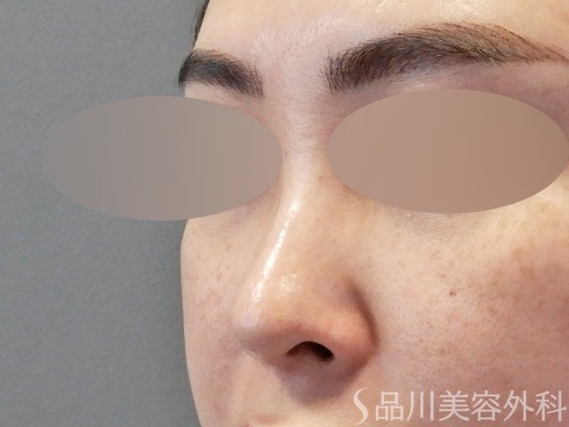 症例NO.67609のBEFORE写真